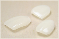 ラミネートベニア