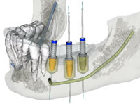 ノーベルクリニシャン