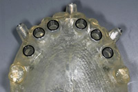 ガイデッド・サージェリー