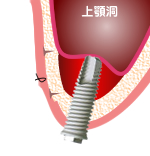 3:血液を満たす