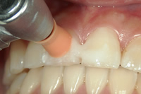 メインテナンス