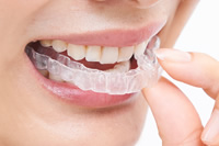 インビザライン