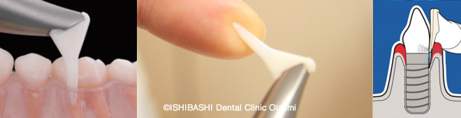 柔らかいチップ