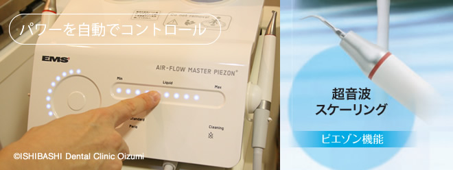 歯石を自動感知